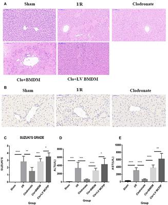 Macrophage Regnase-1 Deletion Deteriorates Liver Ischemia/Reperfusion Injury Through Regulation of Macrophage Polarization